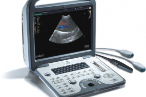 mobile ultrasound